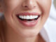 Healthy white smile close up. Beauty woman with perfect smile, lips and teeth. Beautiful Model Girl with perfect skin. Teeth whitening.