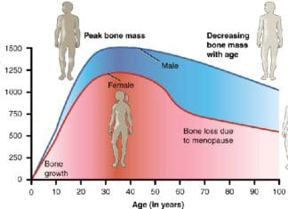 How Strength Training Helps with Osteoporosis 615 Age and Bone Mass Anatomy & Physiology, Connexions Web site. http cnx.org content col11496 1.6 , Jun 19, 2013., CC BY 3.0 https creativecommons.org licenses by 3.0 , via Wikimedia Commons